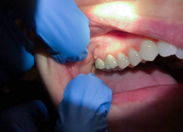 Best 24-Hour Emergency Dentist in Rosaryville, MD