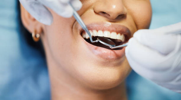 Best Walk-In Emergency Dentist in Rosaryville, MD